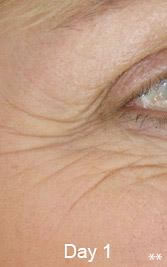 Eyes1