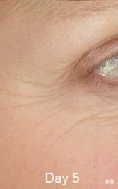 Eyes2