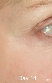 Eyes3